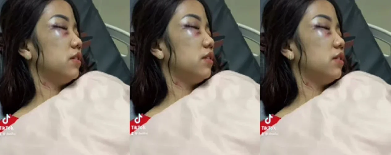 637227001a108-viral-video-wanita-cantik-babak-belur_1265_711